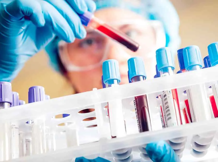 Exámenes de Sangre